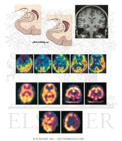 Neuroimaging Studies