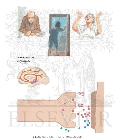 Watermarked preview of unlabeled image: Pharmacologic Management Options In Alzheimer Disease