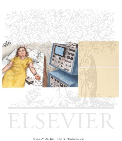 Watermarked preview of unlabeled image: Multiple Sclerosis: Diagnostic Tests - Evoked Responses II