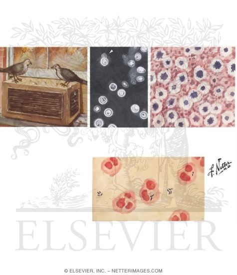 Watermarked preview of unlabeled image: Cryptococcosis and Listeriosis