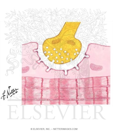 Watermarked preview of unlabeled image: Myasthenia Gravis: Pathophysiologic Concepts