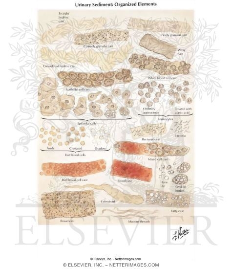 Urinary Sediment: Organized Elements