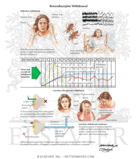 Benzodiazepine Withdrawal