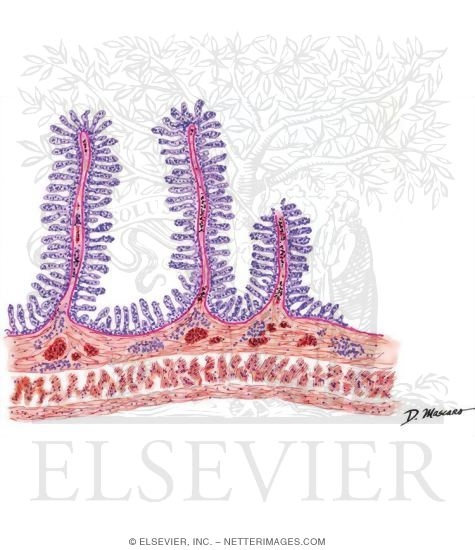 Watermarked preview of unlabeled image: Eosinophilic Gastroenteritis