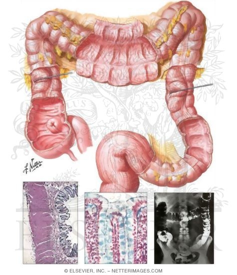 Topography and Structure of the Colon