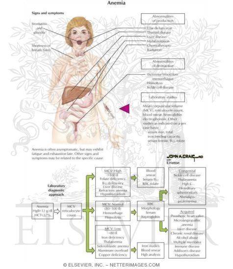 Anemia