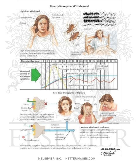 Benzodiazepine Withdrawal