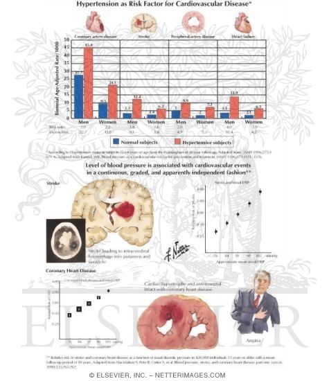 Hypertension As Risk Factor for Cardiovascular Disease