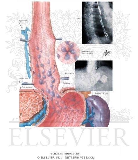 Watermarked preview of unlabeled image: Varicosis