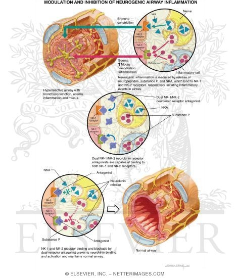 Watermarked preview of labeled image: Modulation and Inhibition of Neurogenic Airway Inflammation