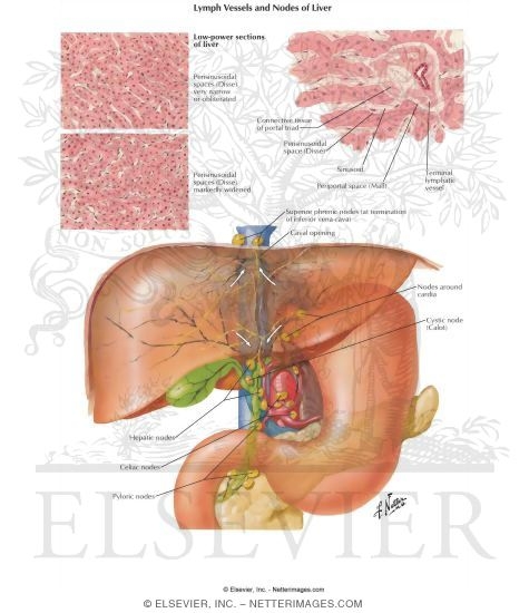 Watermarked preview of labeled image: Lymph Vessels and Nodes of Liver 
Lymphatic Drainage of Liver and Bile Tract