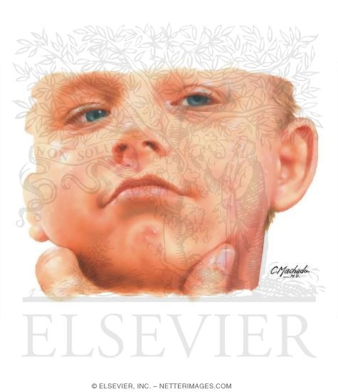 Watermarked preview of unlabeled image: Face Xerosis