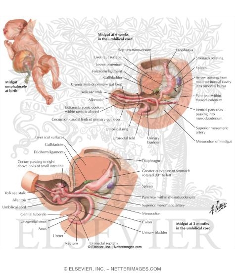Watermarked preview of labeled image: Umbilical Hernia