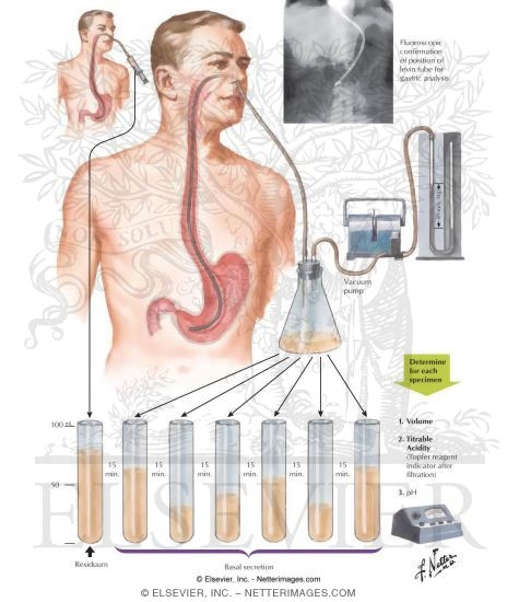 Watermarked preview of unlabeled image: Gastric Analysis