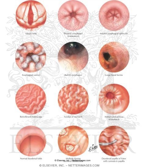 Esophagogastroduodenoscopy