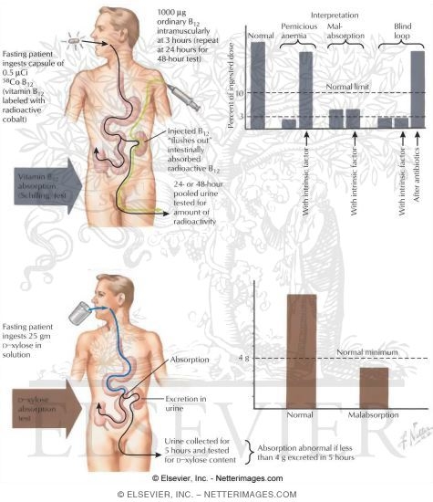 Evaluation of the Small Bowel: D-Xylose Absorption Test and Schilling Test