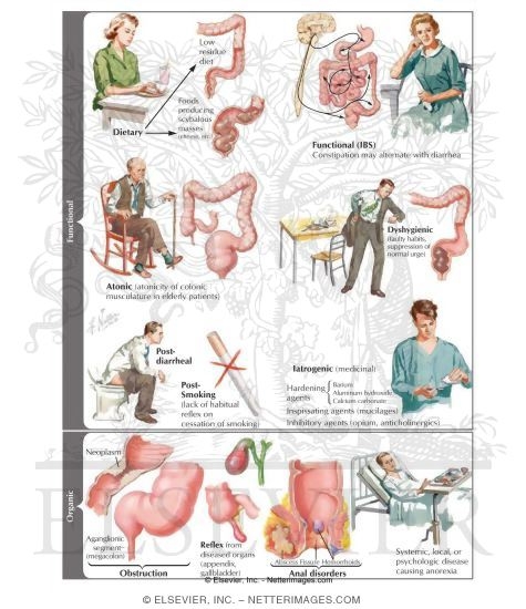 Watermarked preview of labeled image: Constipation