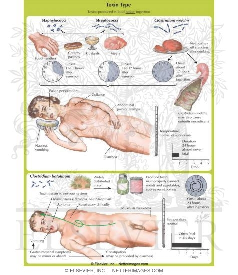 Toxin Type of Food Poisoning