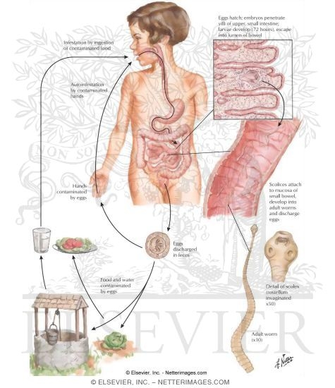 Parasitic Diseases VIII - Hymenolepiasis Nana