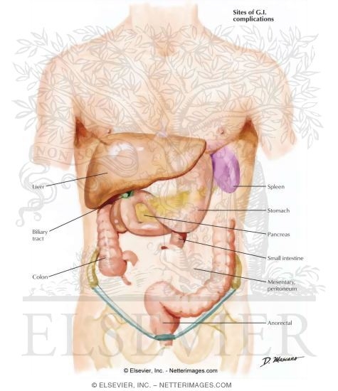 Watermarked preview of labeled image: Human Immunodeficiency Virus and the Gastrointestinal Tract