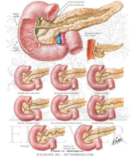 Watermarked preview of unlabeled image: Pancreatic Ducts and Variations