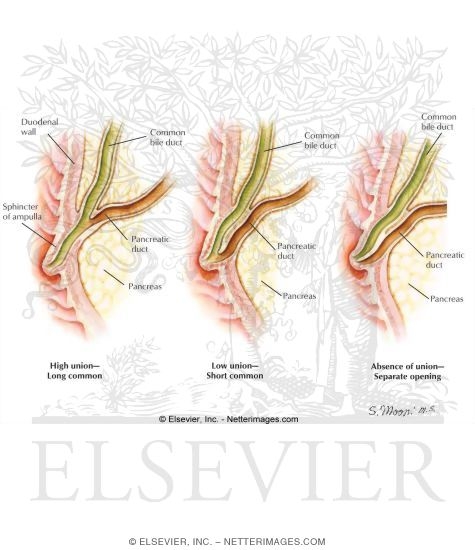 Sphincter of Oddi Dysfunction