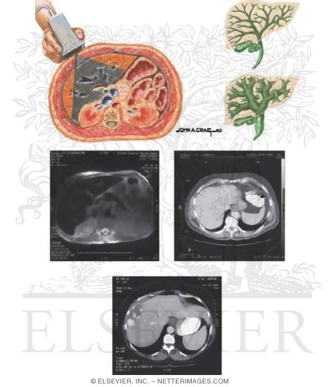Watermarked preview of unlabeled image: Imaging Studies of the Liver