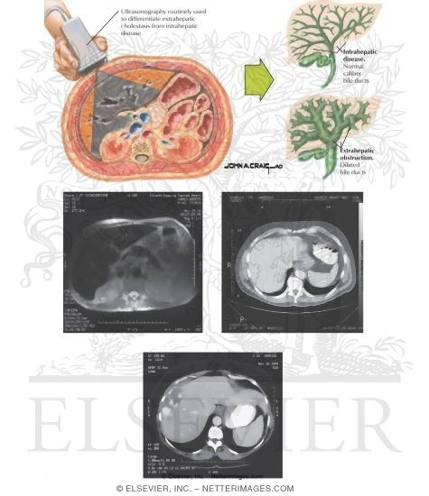 Watermarked preview of labeled image: Imaging Studies of the Liver