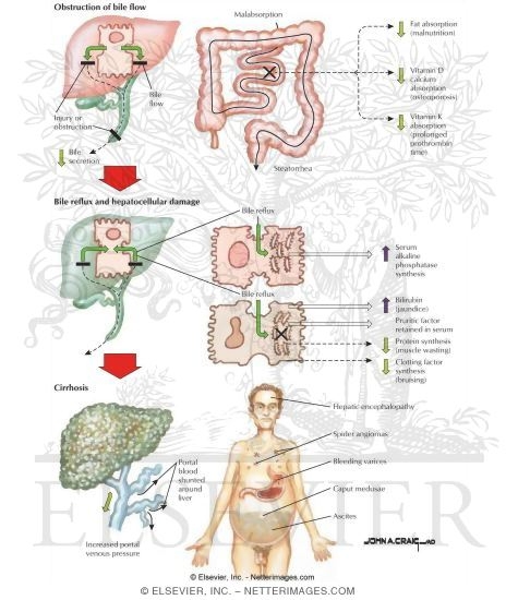 Natural History of Cholestasis