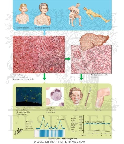 Watermarked preview of labeled image: Chronic Active Hepatitis