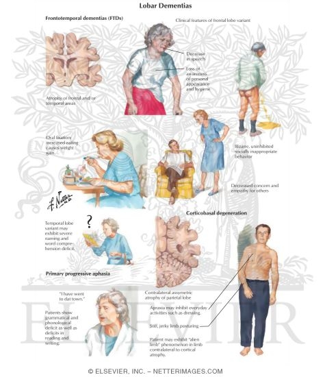 Watermarked preview of labeled image: Lobar Dementias