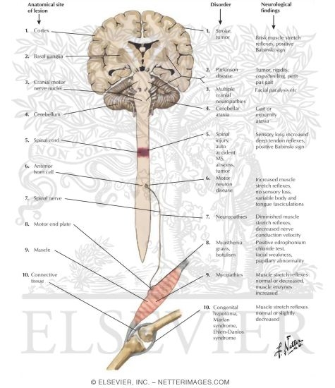 Hypotonia