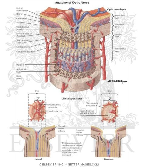 Watermarked preview of labeled image: Anatomy of the Optic Nerve