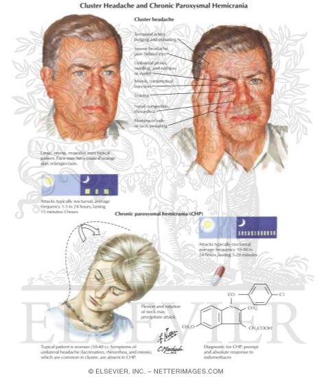 Cluster Headache and Chronic Paroxysmal Hernicrania