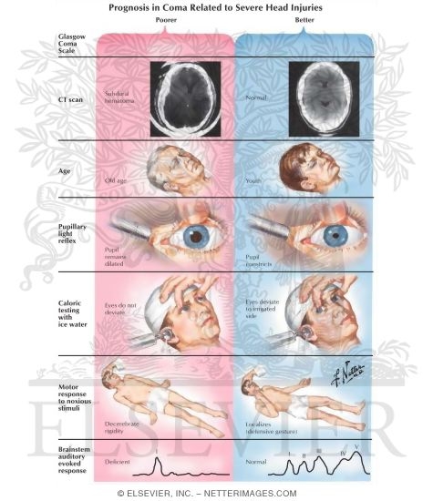 Prognosis In Severe Head Injuries