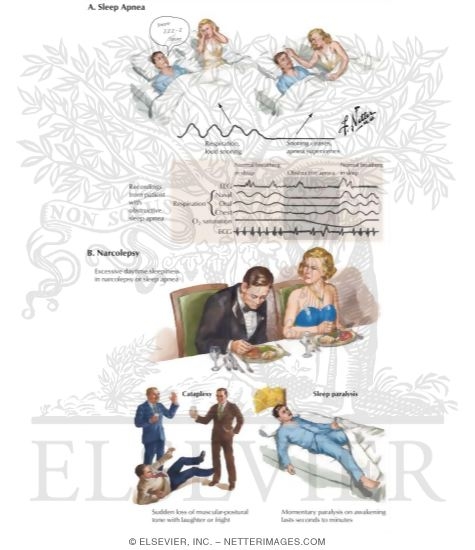 Watermarked preview of labeled image: Sleep Disorders