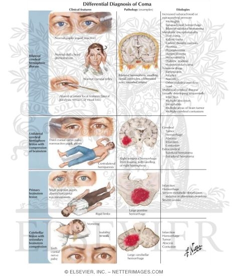 Watermarked preview of labeled image: Differential Diagnosis of Coma