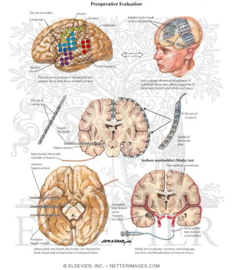 Watermarked preview of labeled image: Preoperative Evaluation