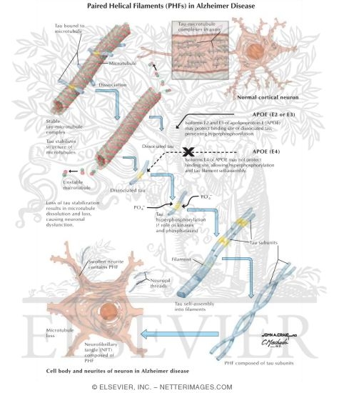 Paired Helical Filaments (PHFs) in Alzheimer's Disease