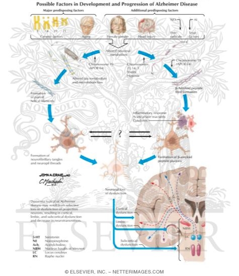 Watermarked preview of labeled image: Possible Factors in Development and Progression of Alzheimer's Disease