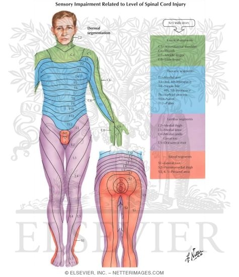 Sensory Impairment Related To Level Of Spinal Cord Injury