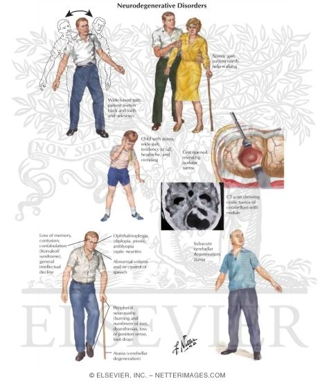 Watermarked preview of labeled image: Neurodegenerative Disorders