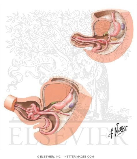 Watermarked preview of unlabeled image: Foregut and Midgut Rotations