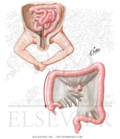 Watermarked preview of unlabeled image: Midgut Loop