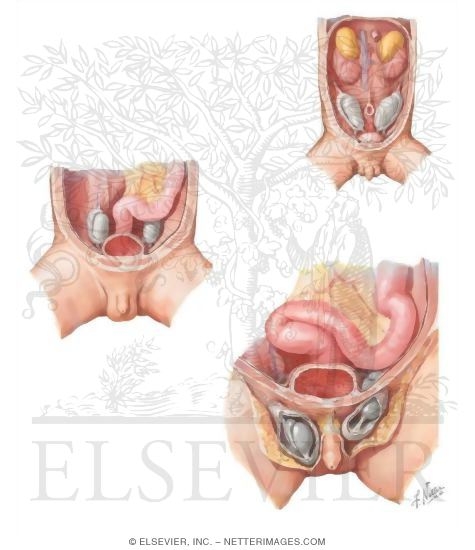Watermarked preview of unlabeled image: Testis Descent Through the Deep Body Wall