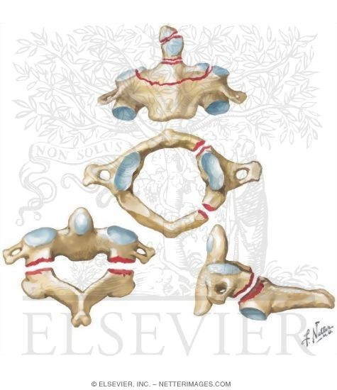 Watermarked preview of unlabeled image: Cervical Vertebral Fractures