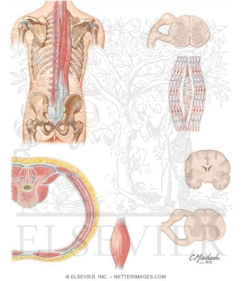 Watermarked preview of unlabeled image: Myofascial Causes of Back Pain