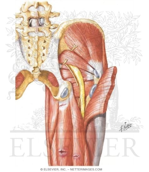 Watermarked preview of unlabeled image: Diagnosis of Hip, Buttock, and Back Pain