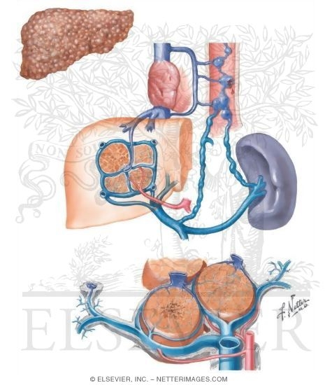 Etiology Of Cirrhosis