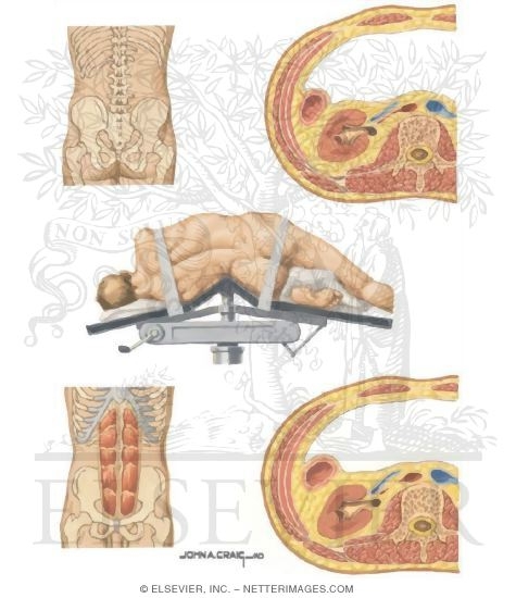 Surgical Approach to the Kidney